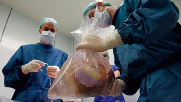В Украине накрыли группировку черных трансплантологов, в которую входил… замминистра здравоохранения